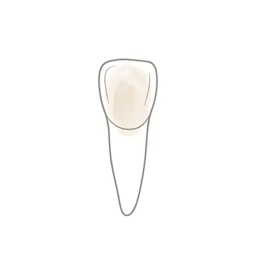 Spaced and uneven teeth before veneers